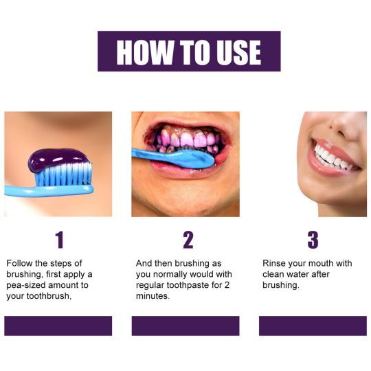 HiSmile V34 Teeth Whitener