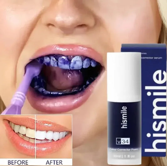 HiSmile V34 Teeth Whitener