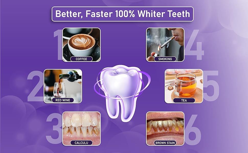 HiSmile V34 Teeth Whitener