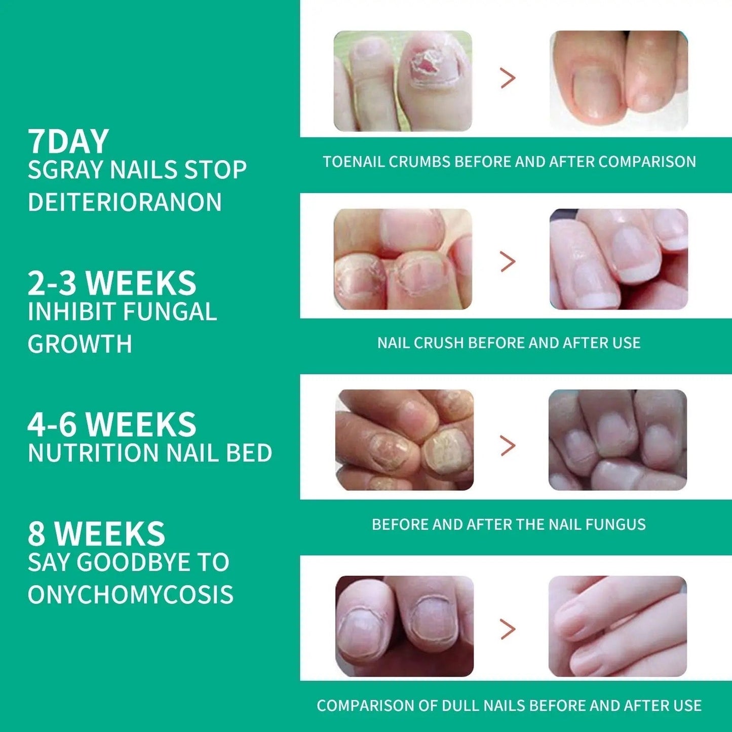 Nail Fungus Serum