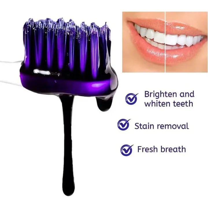 HiSmile V34 Teeth Whitener